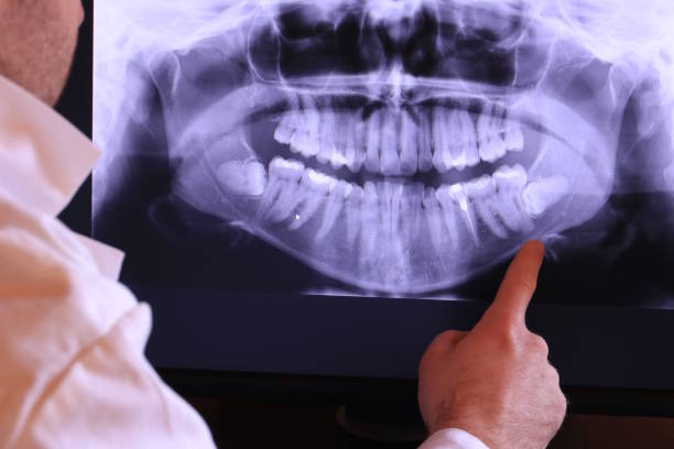 Best After-Hours Emergency Dentist in Maysville, KY